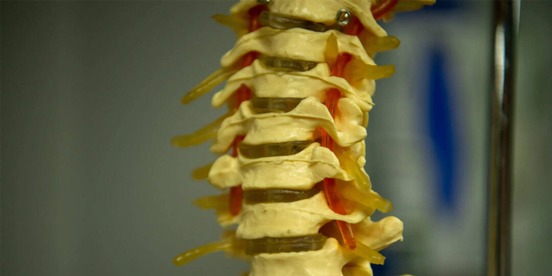 Meeting-Chronic-Pain-Challenges-1080×720 Skelton spine