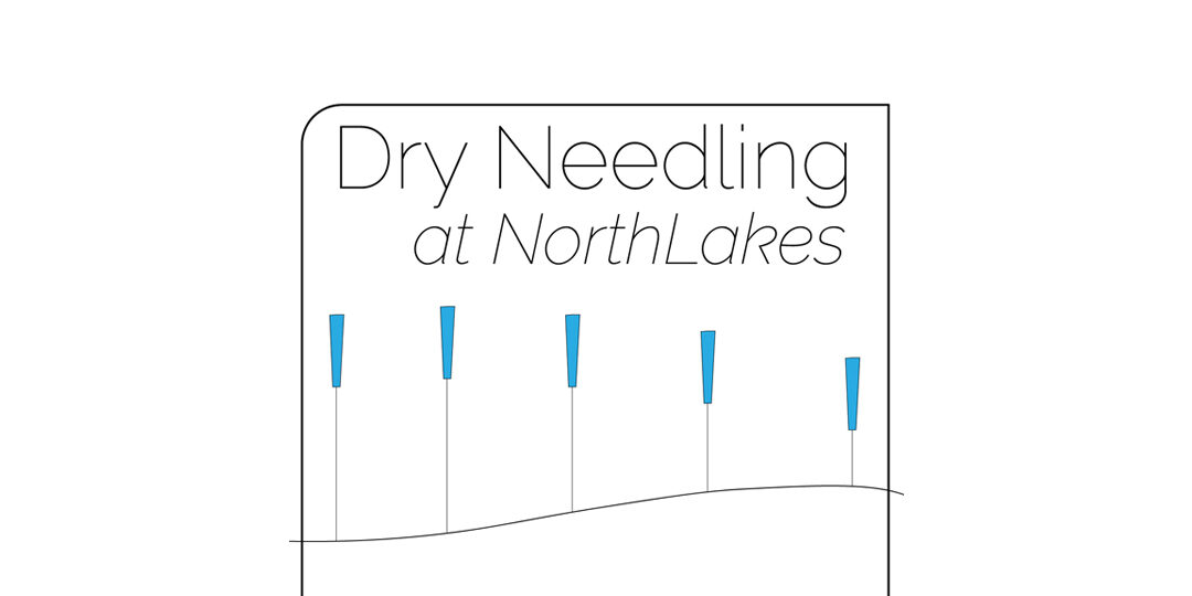 Dry-Needling-at-NorthLakes-Featured-Image Dry Needling at NorthLakes