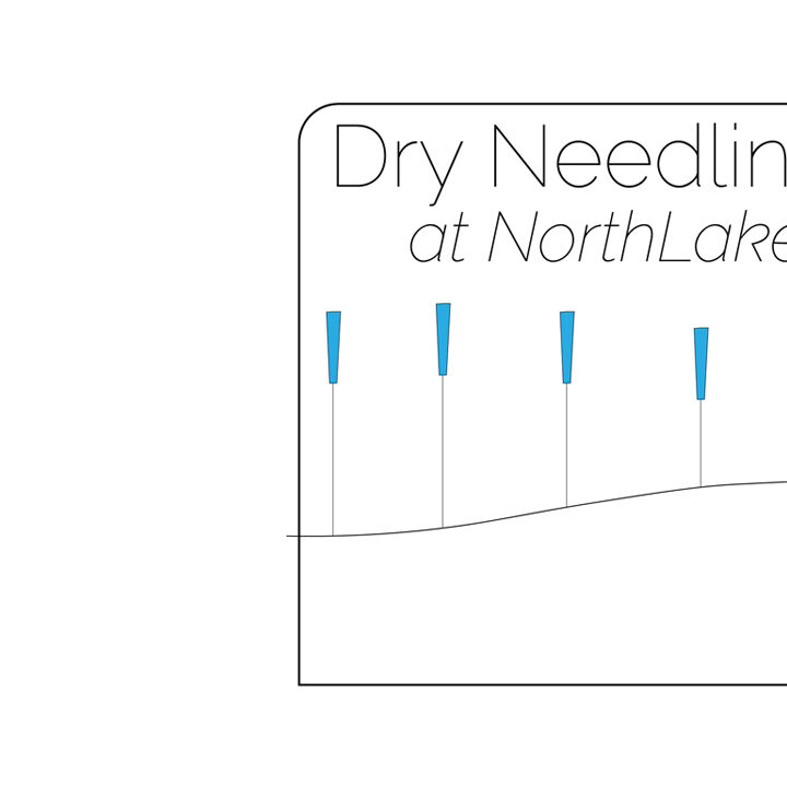 Dry-Needling-at-NorthLakes-Featured-Image Dry Needling at NorthLakes